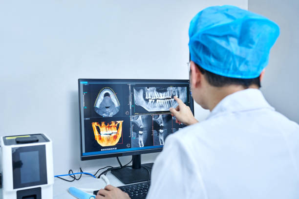 Best Emergency Wisdom Teeth Removal in New Athens, IL